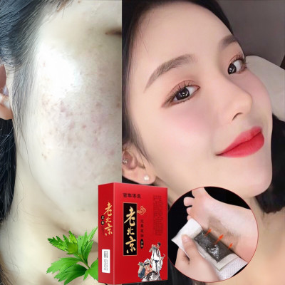 HỘP 50 miếng dán chân thải độc ,các chất cặn bã trong cơ thể qua gan bàn chân