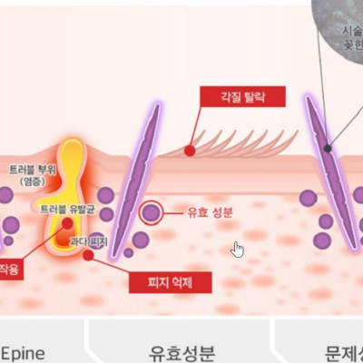 Siêu Vi Kim Lafine Bio Fillertox Ampoule