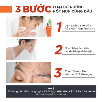 Serum Giảm Mụn Oriss Tinh Chất Tràm Trà Hỗ Trợ Mờ Thâm Sạch Mụn 10g