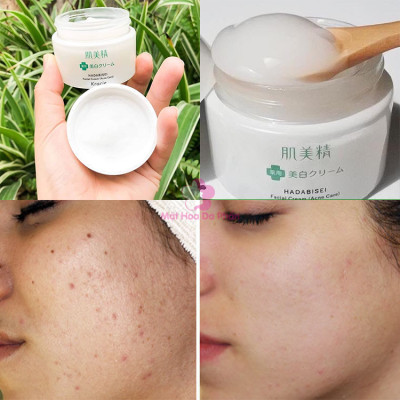 Kem Dưỡng Ẩm Ngăn Ngừa Mụn Kracie Hadabisei Facial Cream Acne Care (50G)