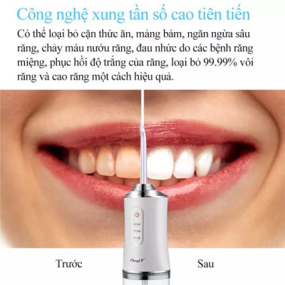 Máy Tăm Nước Cầm Tay - Tăm Nước Vệ Sinh Răng Miệng Oral Irrigator - Bản Quốc Tế Chuẩn Châu Âu