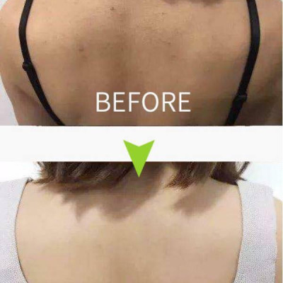 Bộ Xà Phòng Tắm Và Gel Xịt Giảm Mụn Lưng For Back Pelican Nhật Bản Kèm Khăn Thể Thao